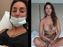 Discover My Exciting Breast Augmentation Journey!