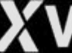 Hotkinkyjo Self Anal Fisting Prolapse