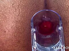 Intense Anal Speculum Gaping On Big Ass Slut With Hairy Pussy