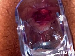 Intense Anal Speculum Gaping On Big Ass Slut With Hairy Pussy