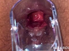 Intense Anal Speculum Gaping On Big Ass Slut With Hairy Pussy