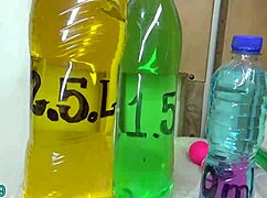 extreme cervix prolapse with bottles hanging of the uterus